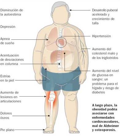 diabetes cintura-altura en niños